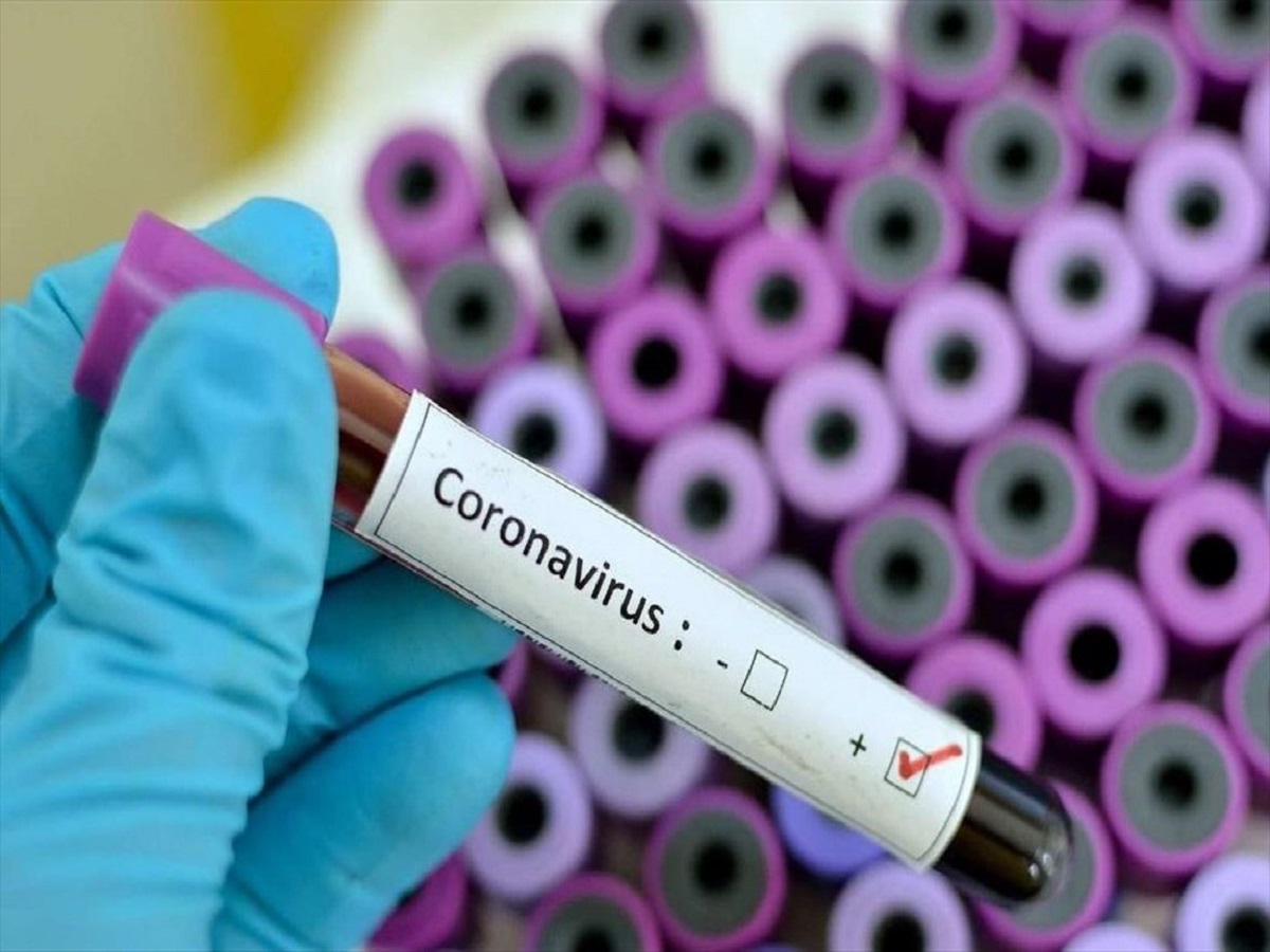 کرونا در ایران؛ تعداد افراد مبتلا به ویروس کرونا به ۹۷۸ نفر افزایش یافت