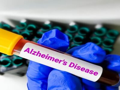 هر ۷ دقیقه یک ایرانی مبتلا به آلزایمر میشود